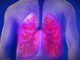 Erkrankungen der Lunge treten in unterschiedlichen Varianten und Altersgruppen auf.